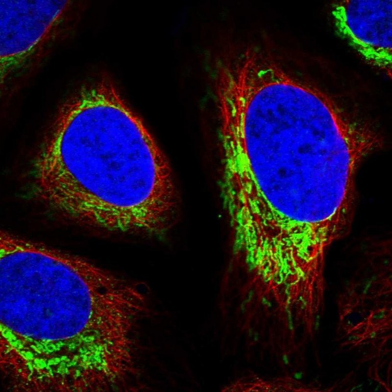 Immunocytochemistry/Immunofluorescence: Pejvakin Antibody [NBP1-87298] - Immunofluorescent staining of human cell line U-2 OS shows positivity in mitochondria.