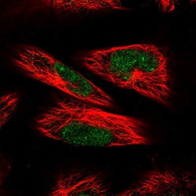 Immunocytochemistry/Immunofluorescence: RPC62 Antibody [NBP1-87111] - Staining of human cell line U-251 MG shows positivity in nucleus but not nucleoli.