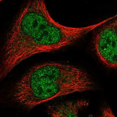 Immunocytochemistry/Immunofluorescence: ELK4 Antibody [NBP1-87092] - Staining of human cell line U-2 OS shows positivity in nucleus but not nucleoli.