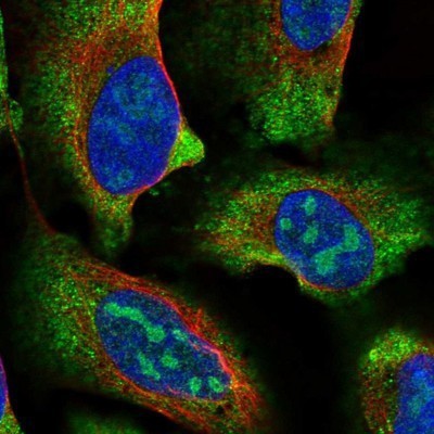 Immunocytochemistry/Immunofluorescence: SDR9C7 Antibody [NBP1-87149] - Staining of human cell line U-2 OS shows positivity in nucleoli & cytoplasm.