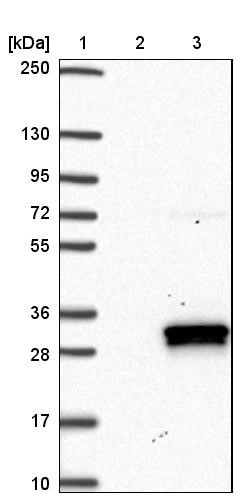Western Blot: Cysteine Dioxygenase Type 1 Antibody [NBP1-87509] - Lane 1: Marker [kDa] 250, 130, 95, 72, 55, 36, 28, 17, 10<br/>Lane 2: Negative control (vector only transfected HEK293T lysate)<br/>Lane 3: Over-expression lysate (Co-expressed with a C-terminal myc-DDK tag (~3.1 kDa) in mammalian HEK293T cells, LY419737)