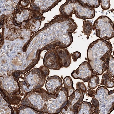 Immunohistochemistry-Paraffin: Cysteine Dioxygenase Type 1 Antibody [NBP1-87509] - Staining of human placenta shows strong cytoplasmic and membranous positivity in trophoblastic cells.