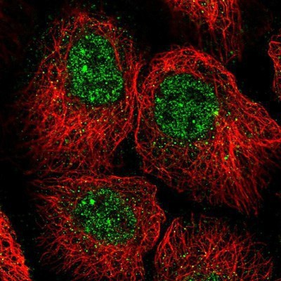 Immunocytochemistry/Immunofluorescence: Eaf6 Antibody [NBP1-90715] - Staining of human cell line A-431 shows positivity in nucleus but not nucleoli.