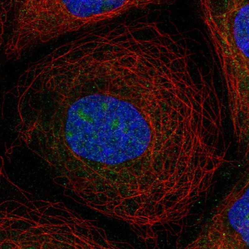 Immunocytochemistry/Immunofluorescence: ZNF404 Antibody [NBP1-90916] - Staining of human cell line A-431 shows positivity in nucleus & nucleoli.
