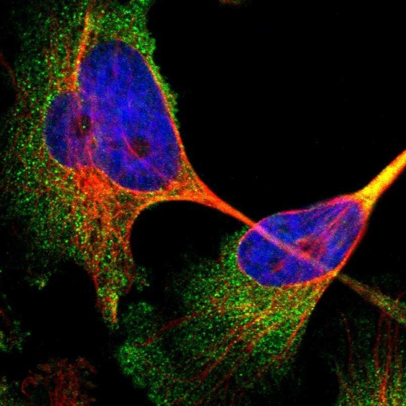 Immunocytochemistry/Immunofluorescence: tetraspanin 14 Antibody [NBP1-90596] - Staining of human cell line U-251MG shows positivity in cytoplasm.