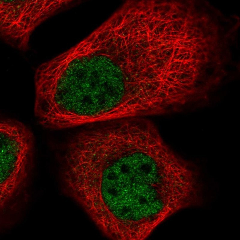 Immunocytochemistry/Immunofluorescence: LAS2 Antibody [NBP1-91719] - Staining of human cell line A-431 shows positivity in nucleus but not nucleoli.