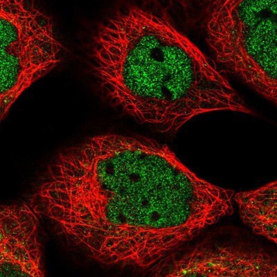 Immunocytochemistry/Immunofluorescence: AXUD1 Antibody [NBP1-91692] - Staining of human cell line A-431 shows positivity in nucleus but not nucleoli.
