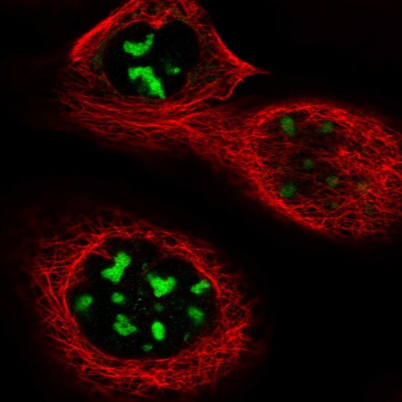 Immunocytochemistry/Immunofluorescence: DIRAS2 Antibody [NBP1-91835] - Staining of human cell line A-431 shows positivity in nucleoli.