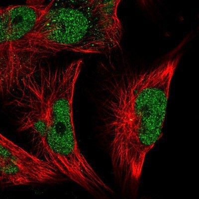 Immunocytochemistry/Immunofluorescence: MSK2 Antibody [NBP1-87844] - Staining of human cell line U-251MG shows positivity in nucleus but not nucleoli.