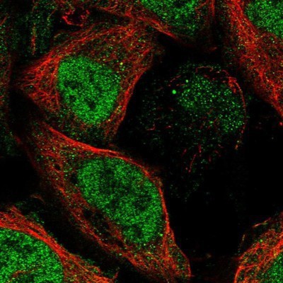 Immunocytochemistry/Immunofluorescence: RKHD3 Antibody [NBP1-87999] - Staining of human cell line U-2 OS shows positivity in nucleus but not nucleoli.