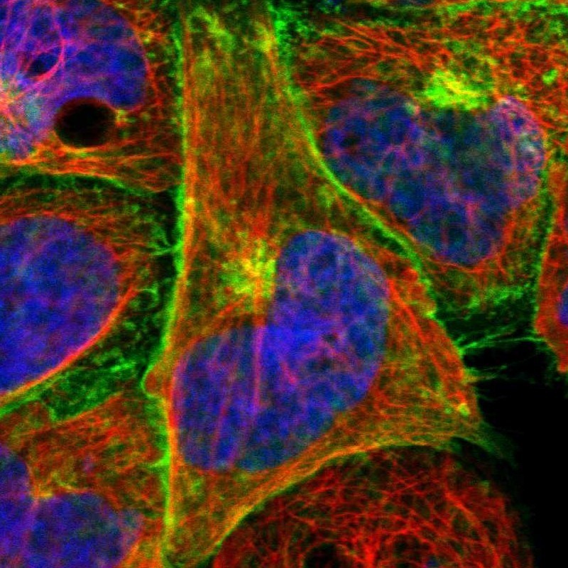 Immunocytochemistry/Immunofluorescence: CNKR2 Antibody [NBP1-88065] - Staining of human cell line A-431 shows positivity in plasma membrane & golgi apparatus.