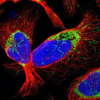 Immunocytochemistry/Immunofluorescence: CCDC44 Antibody [NBP1-88162] - Staining of human cell line U-2 OS shows positivity in mitochondria.