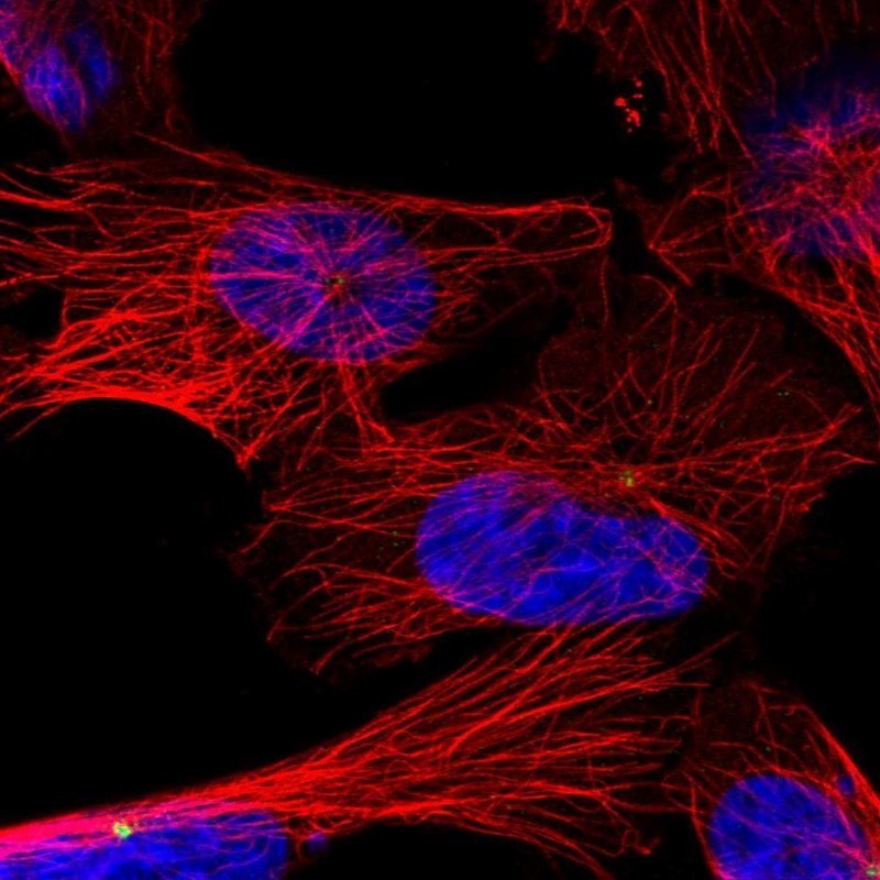 Immunocytochemistry/Immunofluorescence: AGPAT2 Antibody [NBP1-88499] - Staining of human cell line U-251 MG shows positivity in centrosome.