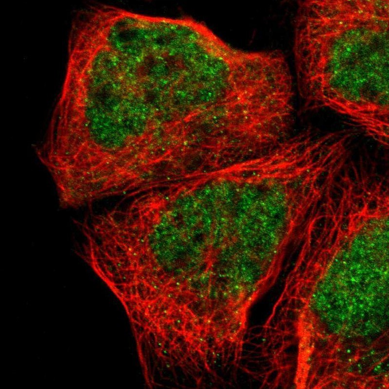 Immunocytochemistry/Immunofluorescence: ABHD12B Antibody [NBP1-88669] - Staining of human cell line A-431 shows positivity in nucleus but not nucleoli.