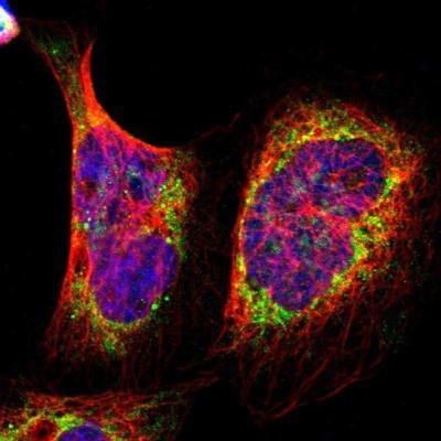 Immunocytochemistry/Immunofluorescence: AIFM3 Antibody [NBP1-89188] - Staining of human cell line A-431 shows positivity in mitochondria.