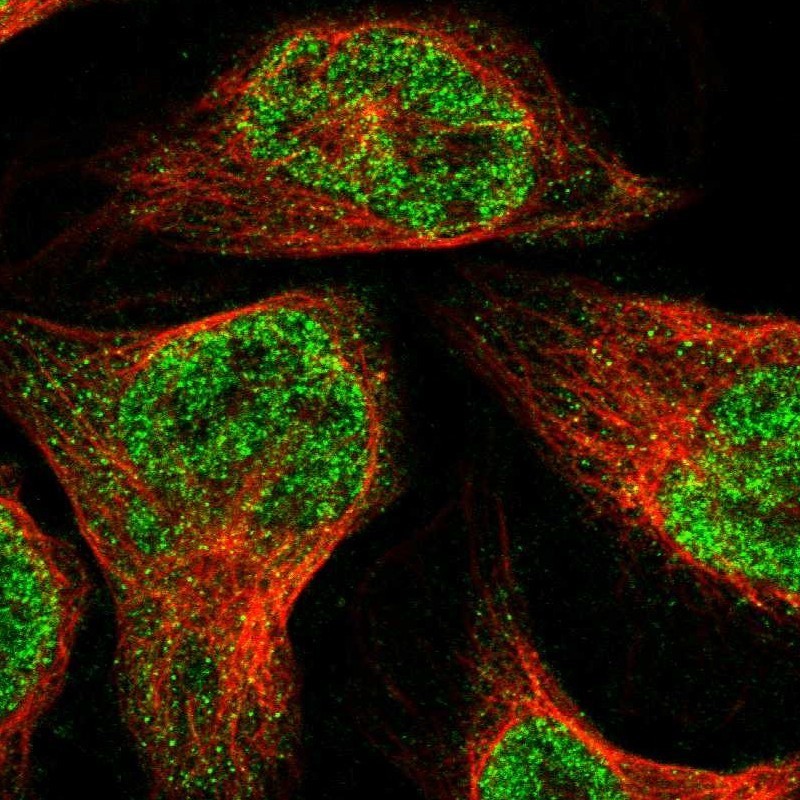 Immunocytochemistry/Immunofluorescence: ZBTB2 Antibody [NBP1-88787] - Staining of human cell line U-2 OS shows positivity in nucleus but not nucleoli.