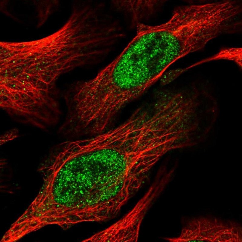 Immunocytochemistry/Immunofluorescence: HMGCLL1 Antibody [NBP1-88768] - Staining of human cell line U-2 OS shows positivity in nucleus but not nucleoli.