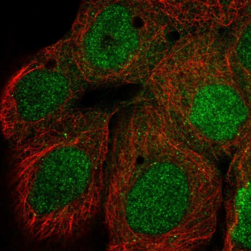 Immunocytochemistry/Immunofluorescence: RhoD Antibody [NBP1-88833] - Staining of human cell line A-431 shows positivity in nucleus.