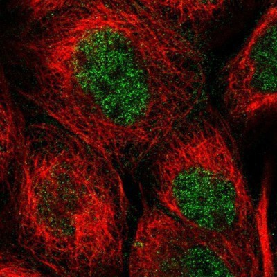 Immunocytochemistry/Immunofluorescence: WIPI2 Antibody [NBP1-88880] - Staining of human cell line A-431 shows positivity in nucleus but not nucleoli.