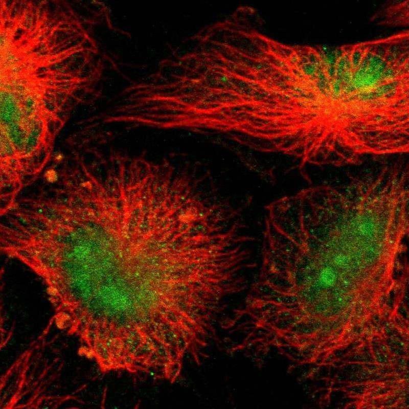 Immunocytochemistry/Immunofluorescence: RhoJ Antibody [NBP1-89012] - Staining of human cell line U-251MG shows positivity in nucleus & nucleoli.