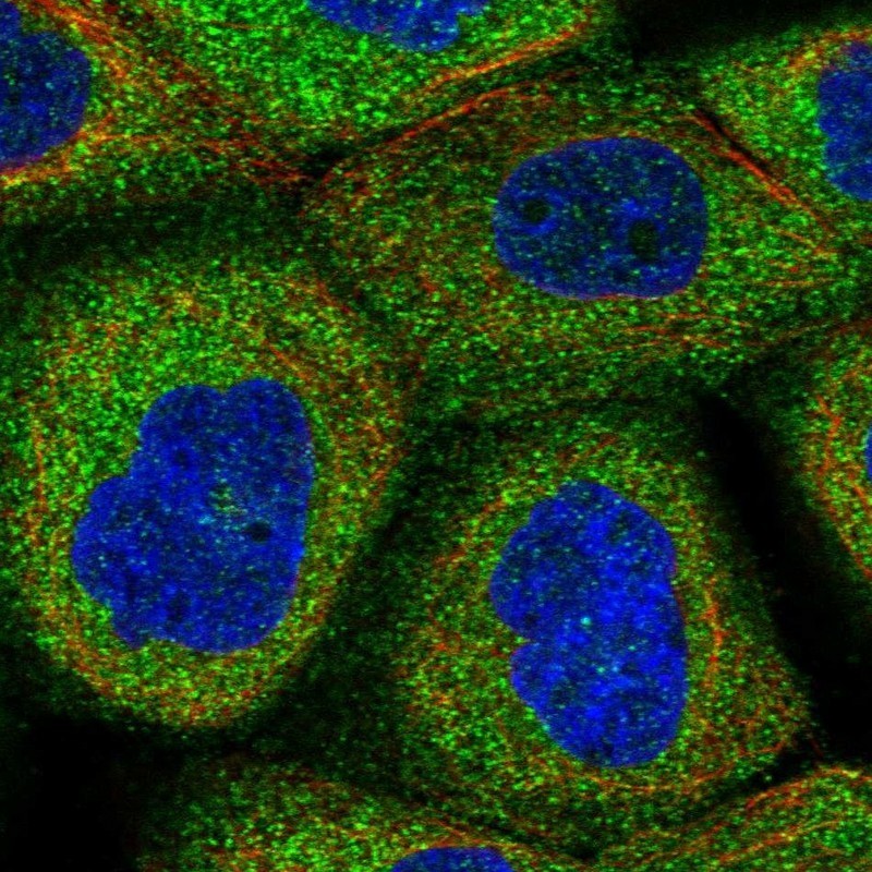 Immunocytochemistry/Immunofluorescence: TRM11 Antibody [NBP1-88250] - Staining of human cell line A-431 shows positivity in cytoplasm.