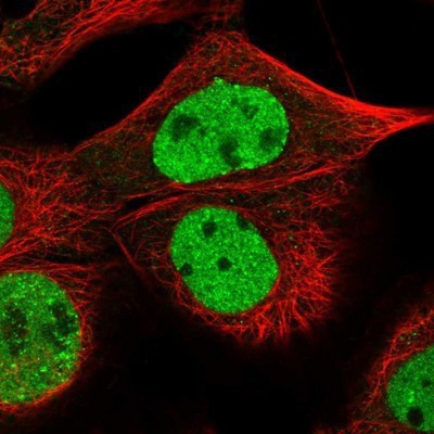 Immunocytochemistry/Immunofluorescence: CHAF1B Antibody [NBP1-88235] - Staining of human cell line A-431 shows positivity in nucleus but not nucleoli.