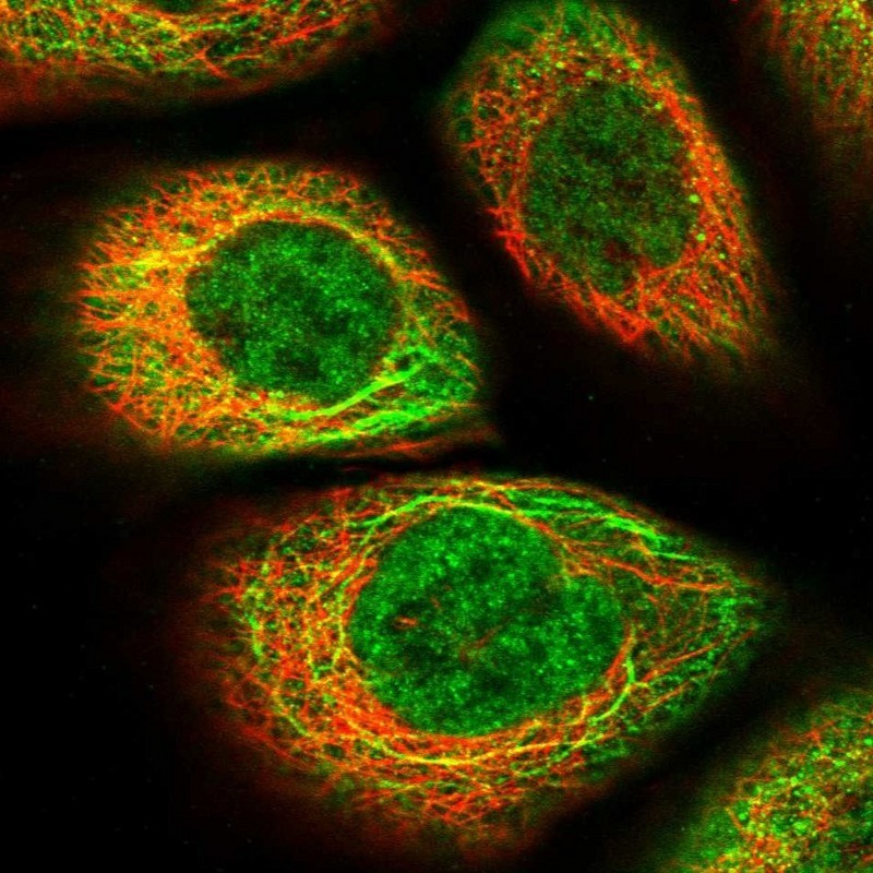 Immunocytochemistry/Immunofluorescence: SLAIN1 Antibody [NBP1-88400] - Staining of human cell line A-431 shows positivity in nucleus but not nucleoli, cytoplasm & cytoskeleton (intermediate filaments).