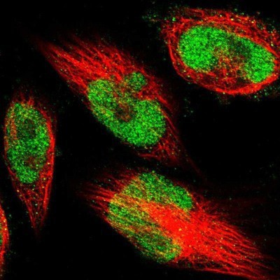 Immunocytochemistry/Immunofluorescence: METTL1 Antibody [NBP1-88386] - Staining of human cell line U-251MG shows positivity in nucleus but not nucleoli.