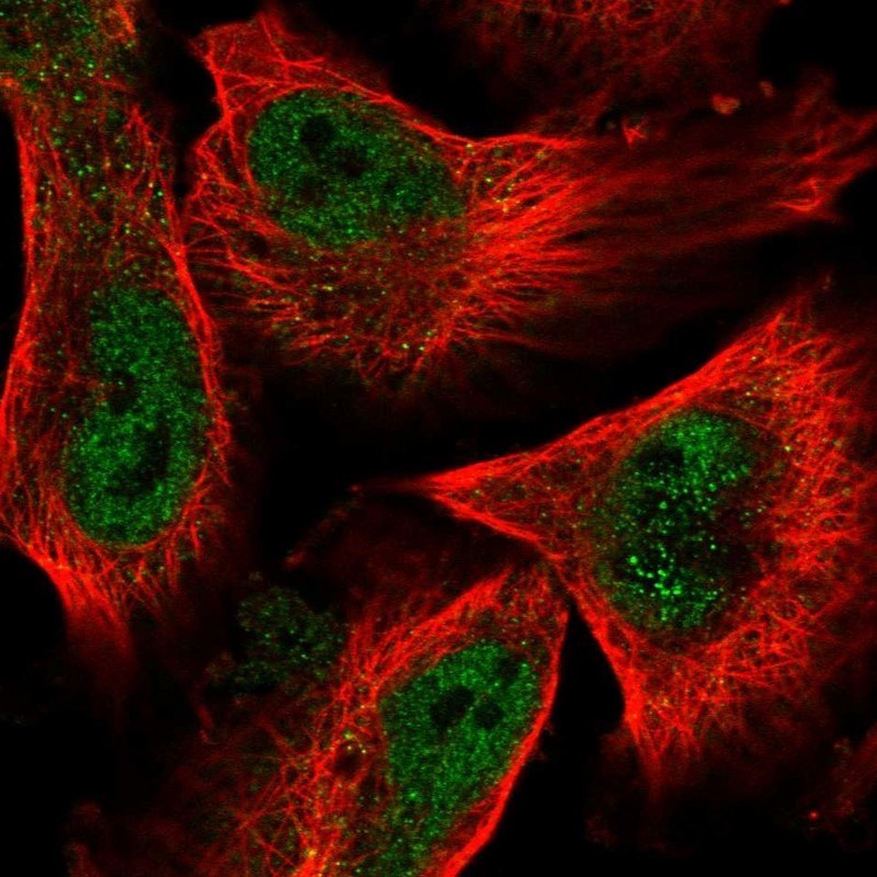 Immunocytochemistry/Immunofluorescence: RPUSD1 Antibody [NBP1-88449] - Staining of human cell line U-251 MG shows positivity in nucleus but not nucleoli.