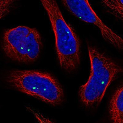 Immunocytochemistry/Immunofluorescence: MSH3 Antibody [NBP1-84965] - Staining of human cell line U-2 OS shows positivity in nucleus.