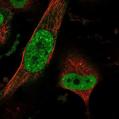 Immunocytochemistry/Immunofluorescence: REXO1 Antibody [NBP1-84862] - Staining of human cell line U-251 MG shows positivity in nucleus but not nucleoli.