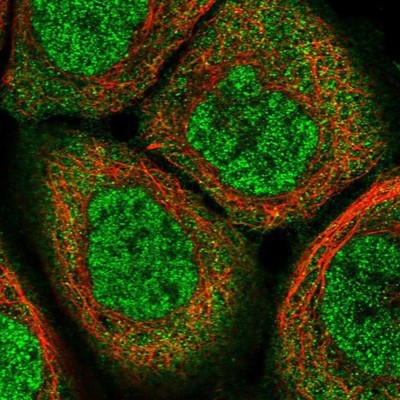Immunocytochemistry/Immunofluorescence: ELMOD1 Antibody [NBP1-85094] - Staining of human cell line A-431 shows positivity in nucleus but not nucleoli & cytoplasm.