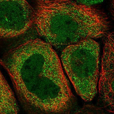 Immunocytochemistry/Immunofluorescence: ELMOD1 Antibody [NBP1-85093] - Staining of human cell line A-431 shows positivity in nucleus but not nucleoli & cytoplasm.
