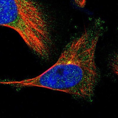 Immunocytochemistry/Immunofluorescence: HSD17B14 Antibody [NBP1-85220] - Staining of human cell line U-251MG shows positivity in cytoplasm & centrosome.
