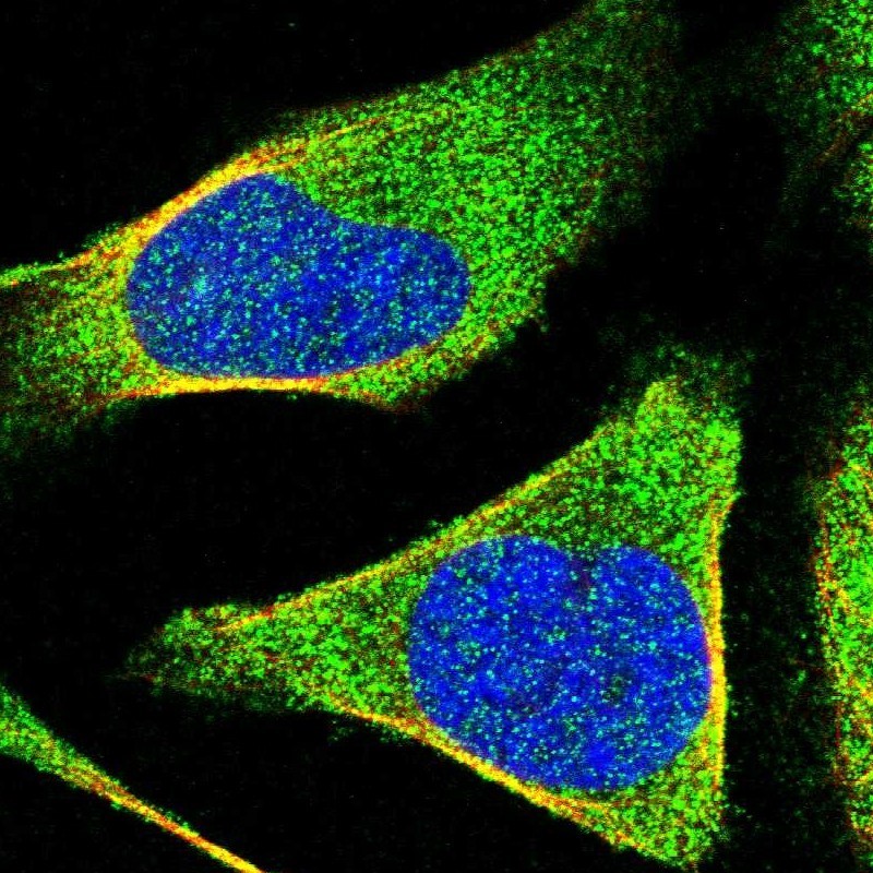 Immunocytochemistry/Immunofluorescence: Kv7.4 Antibody [NBP1-85243] - Staining of human cell line U-2 OS shows positivity in cytoplasm.