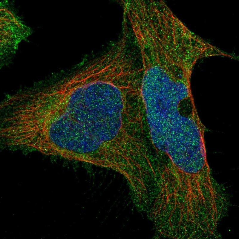 Immunocytochemistry/Immunofluorescence: CDCA3 Antibody [NBP1-83332] - Staining of human cell line U-2 OS shows positivity in cytoplasm.