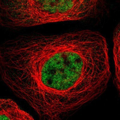Immunocytochemistry/Immunofluorescence: RBM5 Antibody [NBP1-83305] - Staining of human cell line A-431 shows positivity in nucleus but not nucleoli.