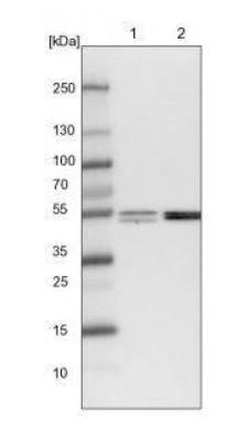 Western Blot: LCoR Antibody [NBP1-83477] -  Lane 1: NIH-3T3 cell lysate (Mouse embryonic fibroblast cells). Lane 2: NBT-II cell lysate (Rat Wistar bladder tumour cells).