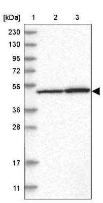 Western Blot: LCoR Antibody [NBP1-83477] - Lane 1: Marker [kDa] 230, 130, 95, 72, 56, 36, 28, 17, 11<br/>Lane 2: Human cell line RT-4<br/>Lane 3: Human cell line U-251MG sp