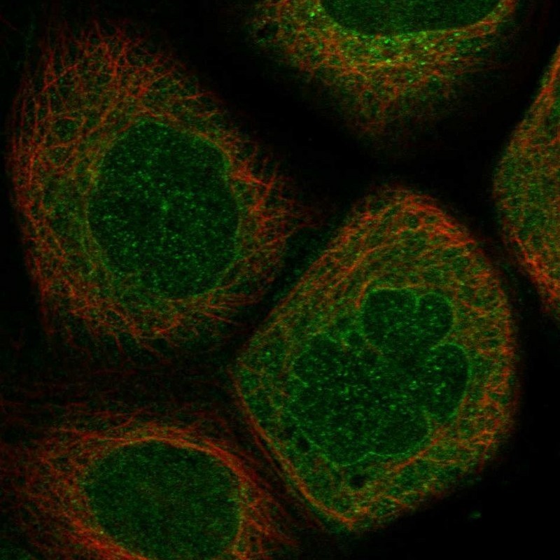 Immunocytochemistry/Immunofluorescence: GGN Antibody [NBP1-83499] - Staining of human cell line A-431 shows positivity in nuclear membrane & cytoplasm.