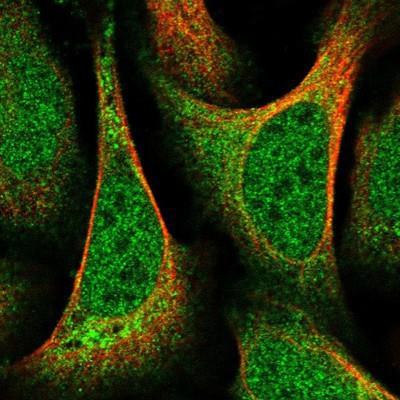 Immunocytochemistry/Immunofluorescence: SNAP29 Antibody [NBP1-84552] - Staining of human cell line U-2 OS shows positivity in nucleus but not nucleoli & cytoplasm.