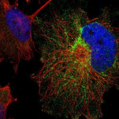 Immunocytochemistry/Immunofluorescence: OXSM Antibody [NBP1-84730] - Staining of human cell line U-251MG shows positivity in cytoplasm & mitochondria.