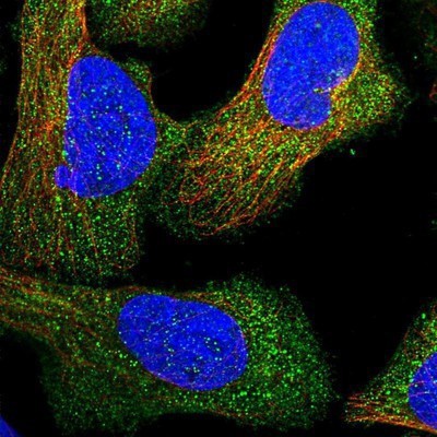 Immunocytochemistry/Immunofluorescence: CCDC78 Antibody [NBP2-14455] - Staining of human cell line U-2 OS shows positivity in cytoplasm.