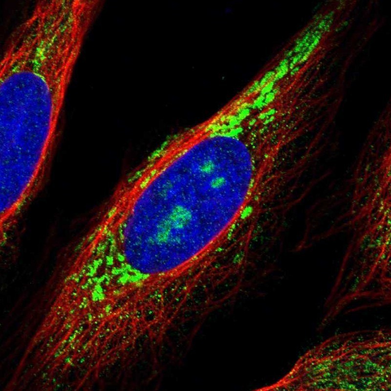 Immunocytochemistry/Immunofluorescence: ZNF364 Antibody [NBP1-85586] - Immunofluorescent staining of human cell line U-2 OS shows positivity in nucleoli & mitochondria.