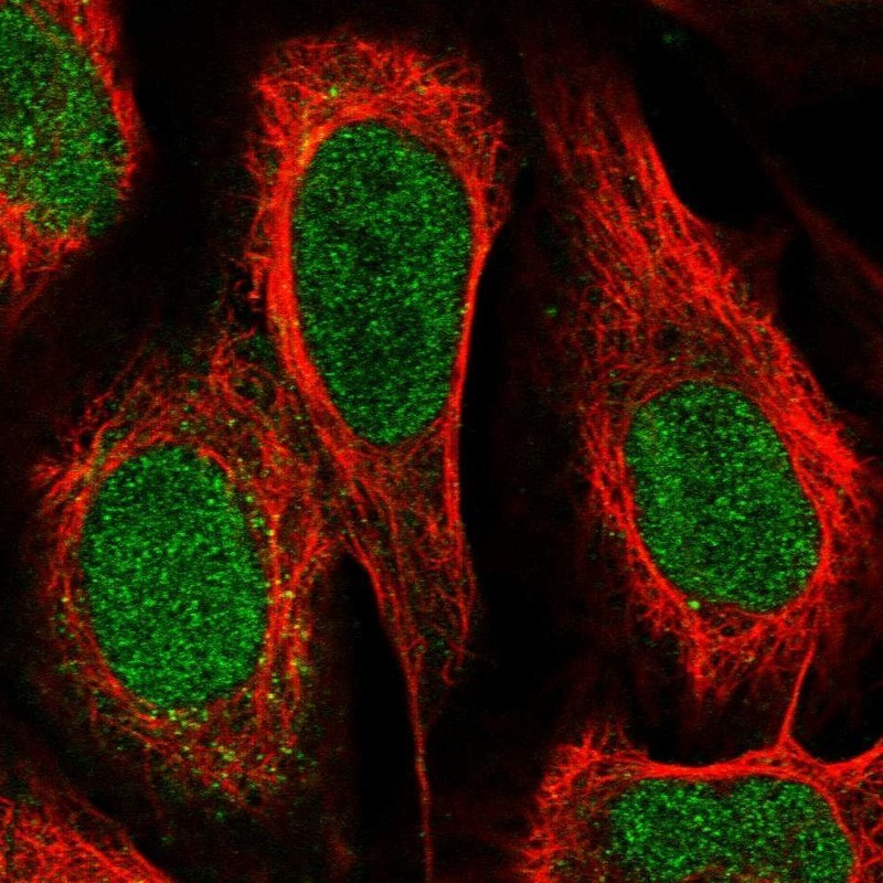 Immunocytochemistry/Immunofluorescence: PPP1R36 Antibody [NBP1-85888] - Immunofluorescent staining of human cell line U-2 OS shows positivity in nucleus.