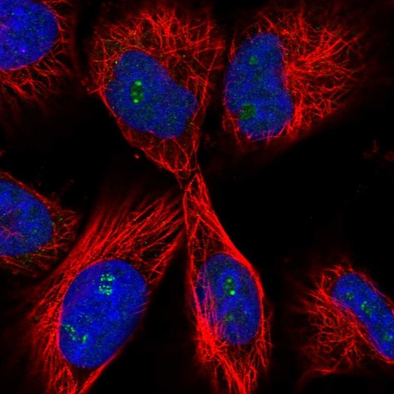 Immunocytochemistry/Immunofluorescence: C1orf105 Antibody [NBP1-86381] - Immunofluorescent staining of human cell line U-251 MG shows positivity in nucleoli.