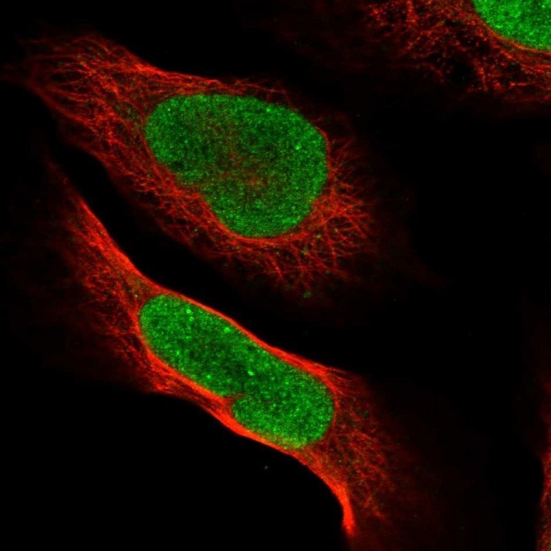Immunocytochemistry/Immunofluorescence: PVRL1 Antibody [NBP1-86554] - Immunofluorescent staining of human cell line U-2 OS shows positivity in nucleus but not nucleoli.