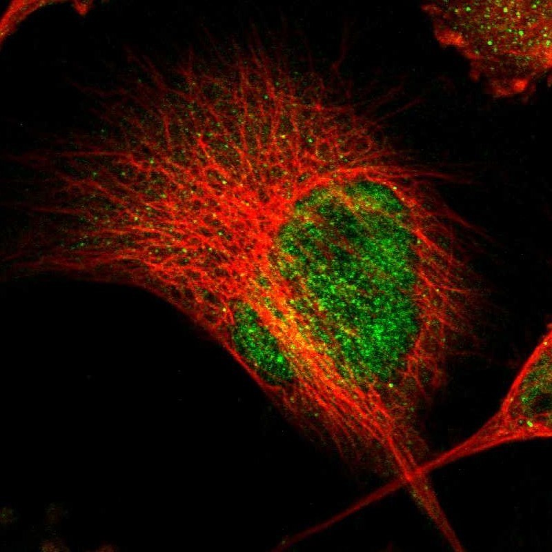 Immunocytochemistry/Immunofluorescence: SOX30 Antibody [NBP1-86503] - Immunofluorescent staining of human cell line U-251MG shows positivity in nucleus but not nucleoli & cytoplasm.