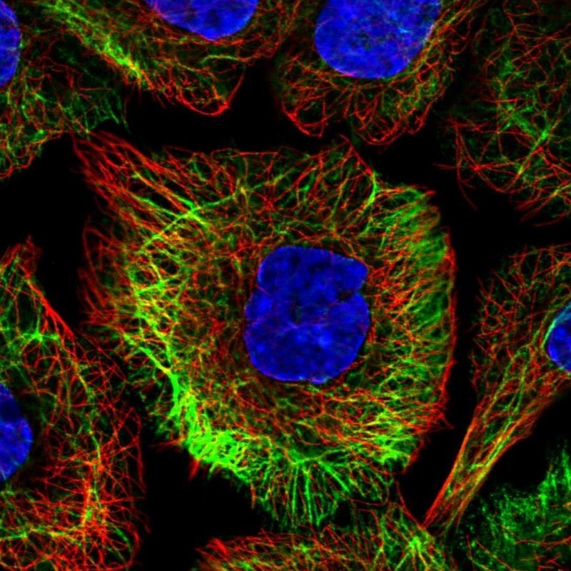 Immunocytochemistry/Immunofluorescence: TRIM32 Antibody [NBP2-13484] - Staining of human cell line A-431 shows positivity in cytoskeleton (intermediate filaments).