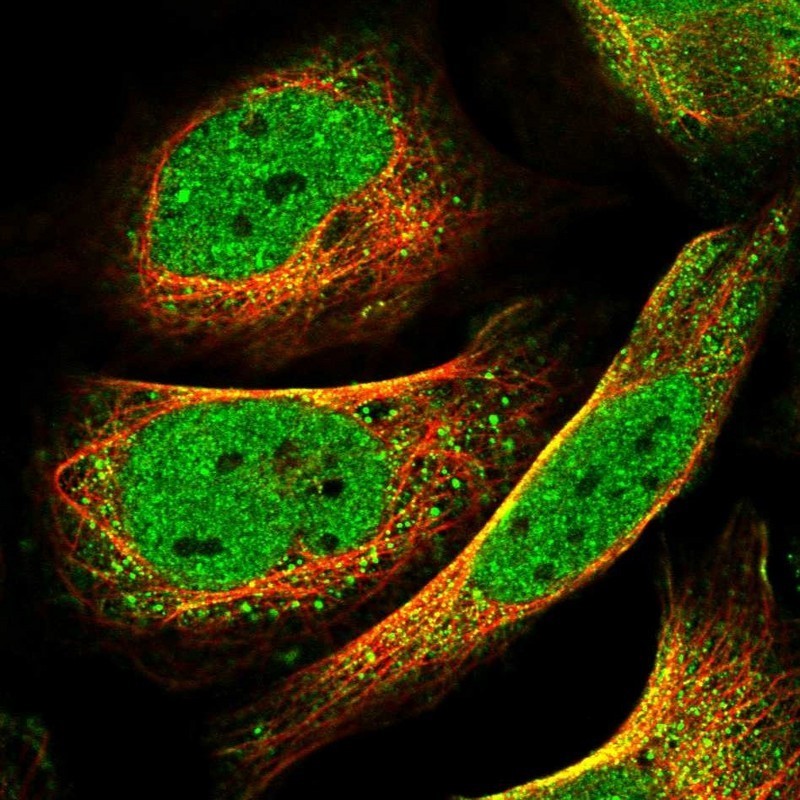 Immunocytochemistry/Immunofluorescence: CDKN2A Interacting Protein Antibody [NBP1-86628] - Immunofluorescent staining of human cell line U-2 OS shows positivity in nucleus & cytoplasm.